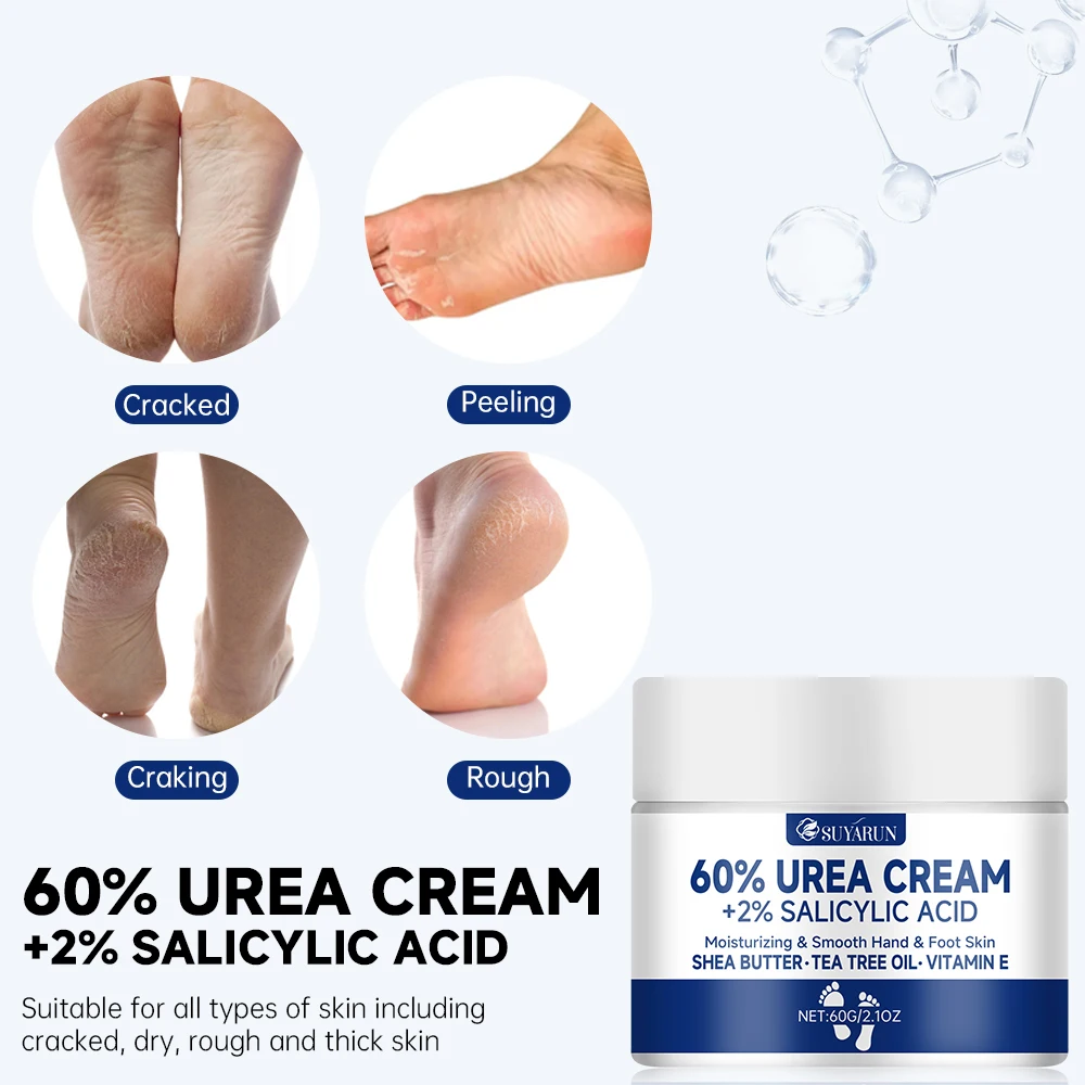 SUYARUN 60% Urea Foot Cream for Cracked Heels & Dry Skin - Intensive Moisturizing Treatment, Callus Remover, Diabetic Foot Care. - Image 5